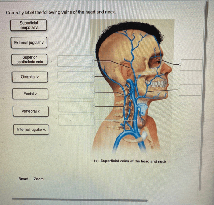 Correctly brainstem solved